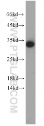 10095-2-AP - EEF1B