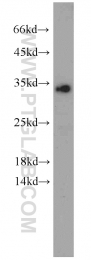 10095-2-AP - EEF1B