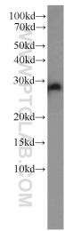 10095-2-AP - EEF1B