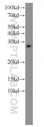 10095-2-AP - EEF1B