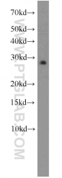 10095-2-AP - EEF1B