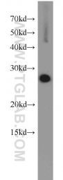 10095-2-AP - EEF1B