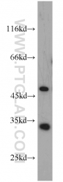10483-1-AP - EEF1B