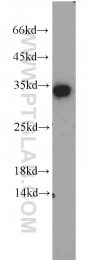 10483-1-AP - EEF1B