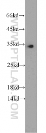 10483-1-AP - EEF1B