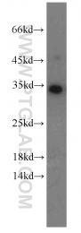 10483-1-AP - EEF1B