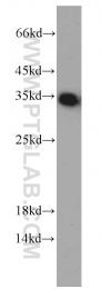 10483-1-AP - EEF1B