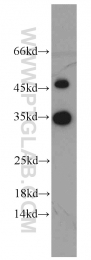 10483-1-AP - EEF1B