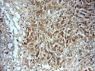 20107-1-AP - EEF2