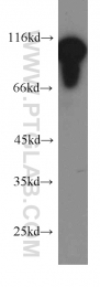 20107-1-AP - EEF2