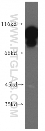 20107-1-AP - EEF2