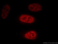 10208-1-AP - U5-116 kDa / EFTUD2