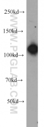 10208-1-AP - U5-116 kDa / EFTUD2
