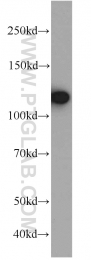10208-1-AP - U5-116 kDa / EFTUD2