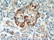 11233-1-AP - EIF2A