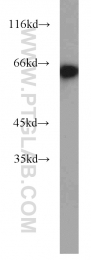 11233-1-AP - EIF2A