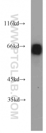 11233-1-AP - EIF2A