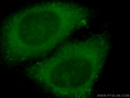 20499-1-AP - EIF2AK1 / HRI