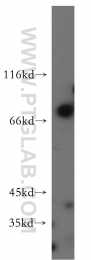 20499-1-AP - EIF2AK1 / HRI