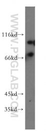 20499-1-AP - EIF2AK1 / HRI