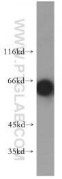18244-1-AP - EIF2AK2 / PKR