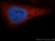 11170-1-AP - EIF2A / EIF2S1
