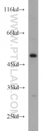 11162-1-AP - EIF2G / EIF2S3