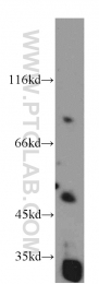 10899-1-AP - EIF3E / EIF3S6