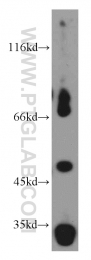 10899-1-AP - EIF3E / EIF3S6