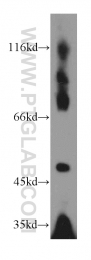 10899-1-AP - EIF3E / EIF3S6