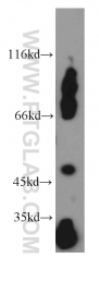 10899-1-AP - EIF3E / EIF3S6