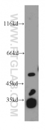 10899-1-AP - EIF3E / EIF3S6