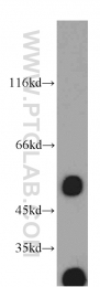 10899-1-AP - EIF3E / EIF3S6