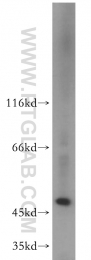 11352-1-AP - EIF3E / EIF3S6