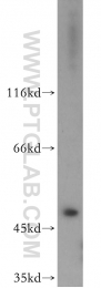 11352-1-AP - EIF3E / EIF3S6