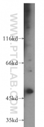 11352-1-AP - EIF3E / EIF3S6