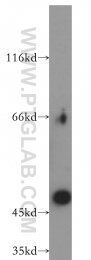 11352-1-AP - EIF3E / EIF3S6