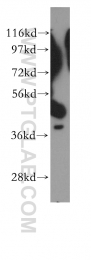 11310-1-AP - EIF3H / EIF3S3