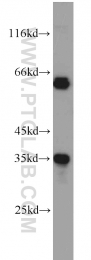 10439-1-AP - EIF3J / EIF3S1