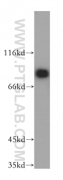 17917-1-AP - EIF4B