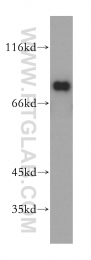 17917-1-AP - EIF4B
