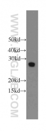 12227-1-AP - EIF4E2 / EIF4EL3