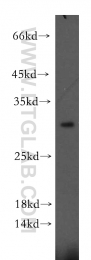 12227-1-AP - EIF4E2 / EIF4EL3