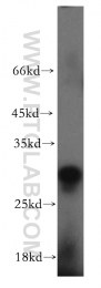 12227-1-AP - EIF4E2 / EIF4EL3