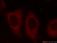 15704-1-AP - EIF4G1 / EIF4F