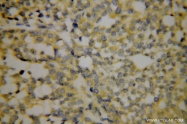 15704-1-AP - EIF4G1 / EIF4F