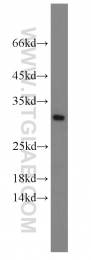 10291-1-AP - EIF6 / ITGB4BP