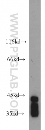 14008-1-AP - ELAVL2 / HUB