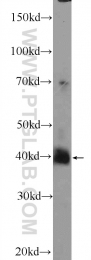 24992-1-AP - ELAVL4 / HUD