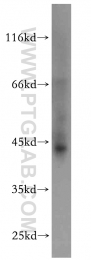 21160-1-AP - ELOVL6
